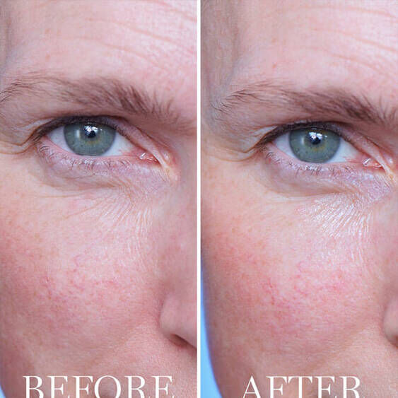 ADVANCED GENIFIQUE VOOR DE OGEN