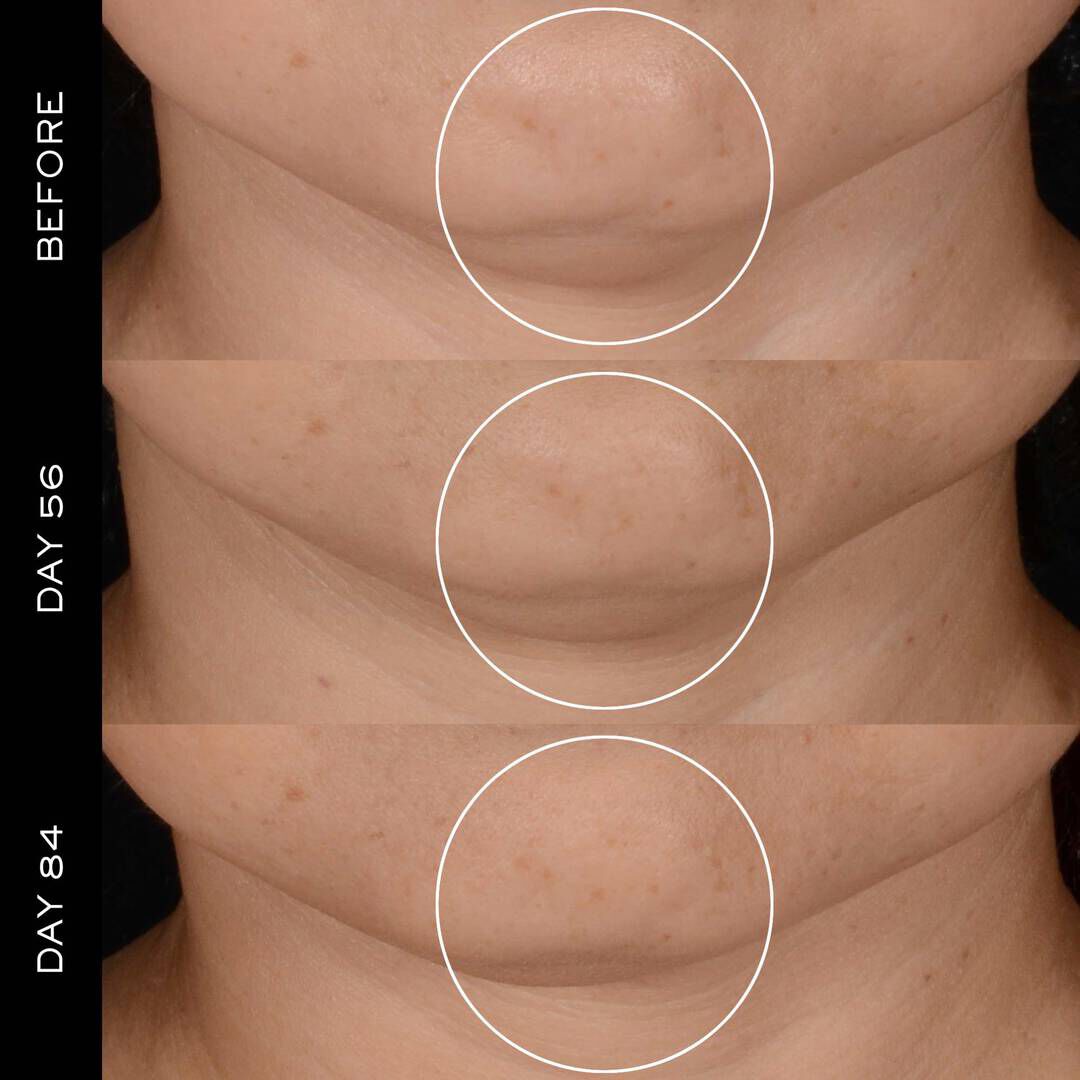 Renergie H.P.N. 300-Peptide Creme 50ml + Navulling