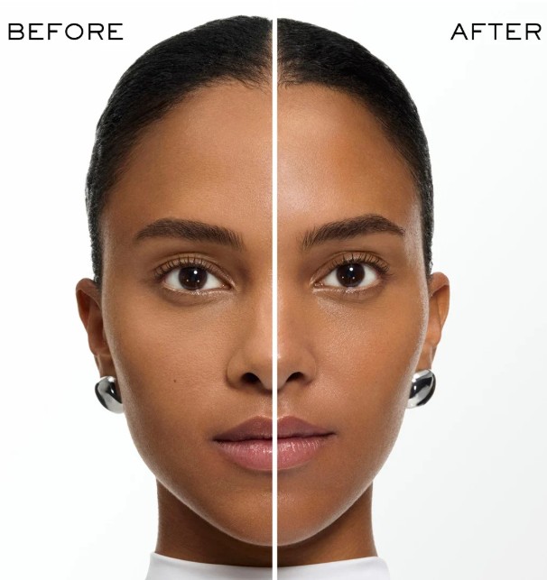 before after